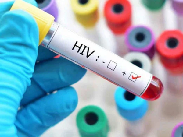 Concerns expressed over rising HIV cases